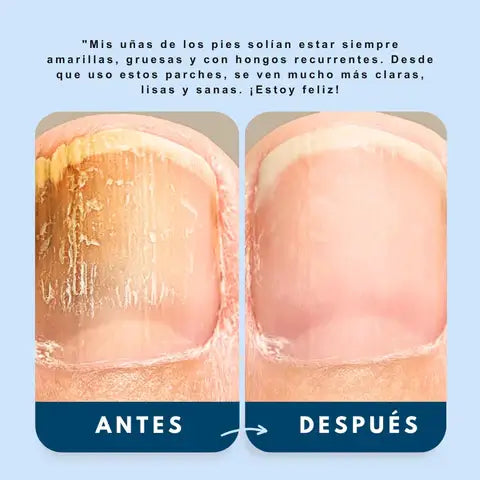 2x1 NailRestore - Tus uñas de vuelta a la normalidad